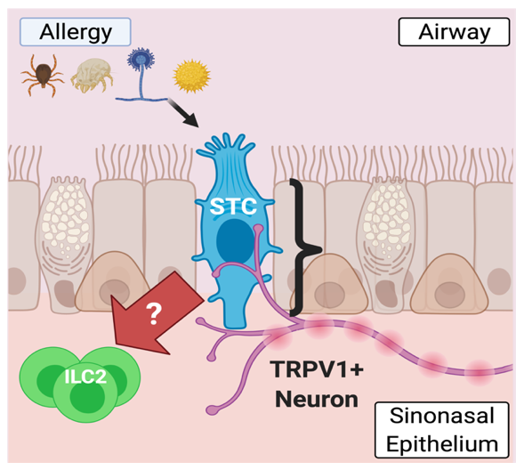 Sinonasal Type 2 Inflammation cycle.