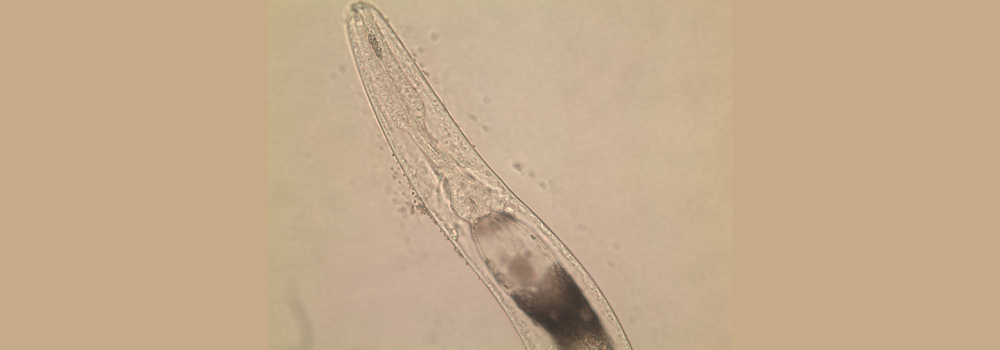 Free living adult female S. stercoralis 