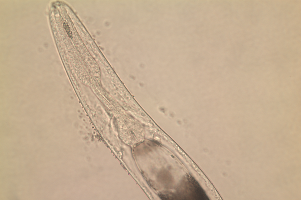 Free living adult female S. stercoralis 