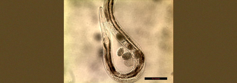 Free living adult female S. stercoralis 