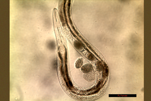 Free living adult female S. stercoralis 