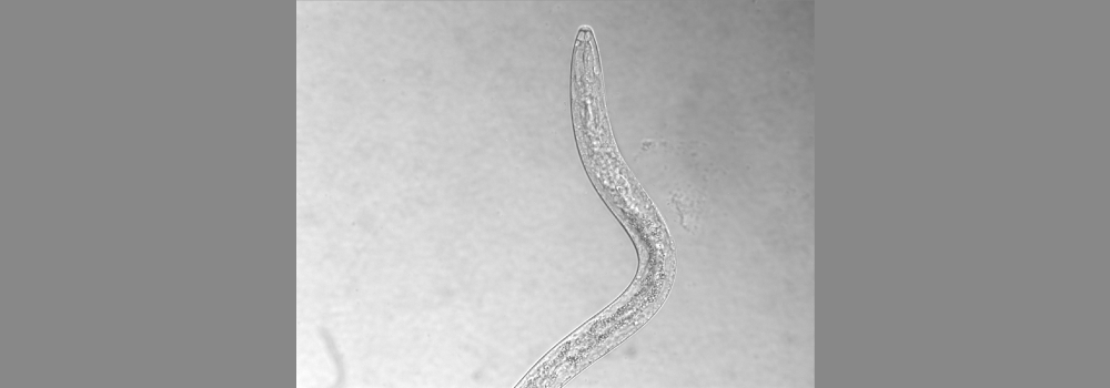 L1 S. stercoralis 