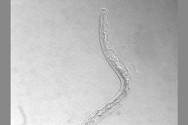 L1 S. stercoralis 